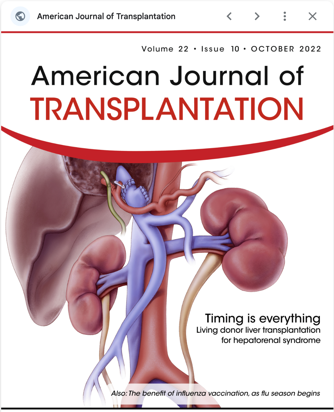 American Journal of Transplantation cover