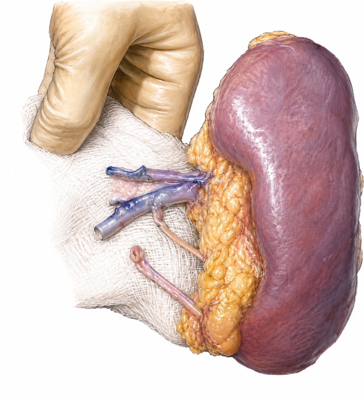 Illustrated kidney transplant image representing the ART webinar series